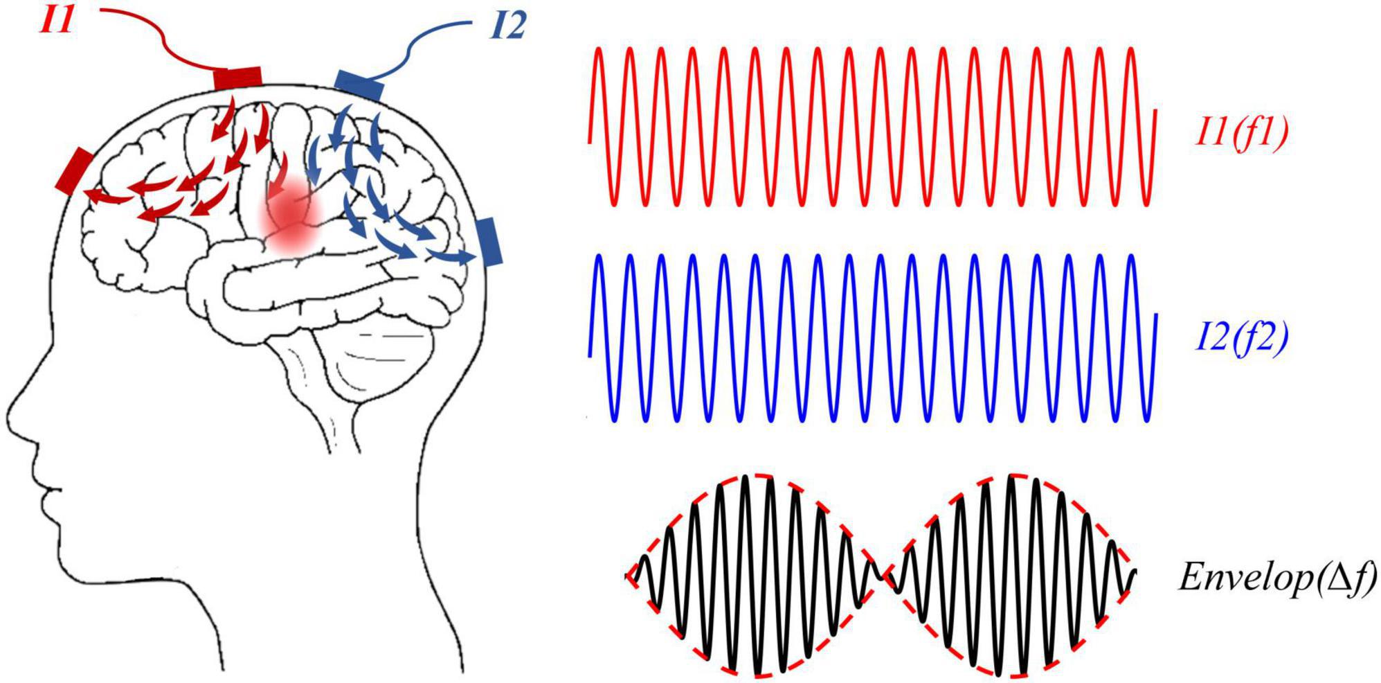 A novel non-invasive brain stimulation technique: “Temporally interfering electrical stimulation”